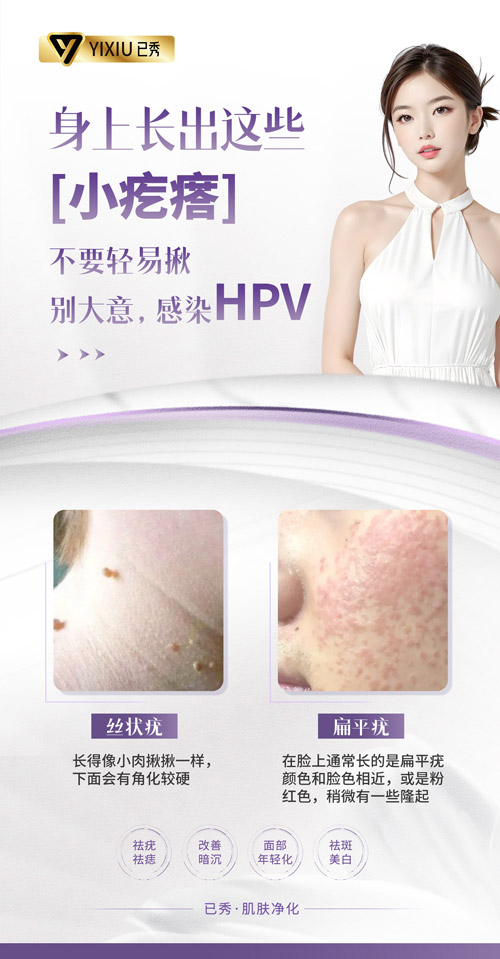 留纤是怎么减肥